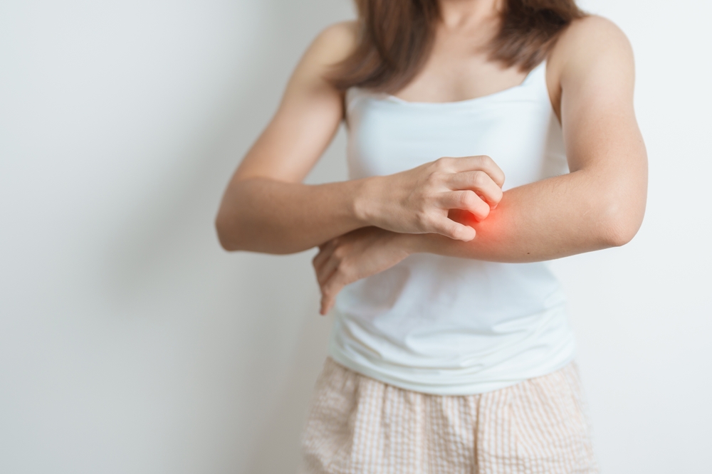Lupus Rash or Rosacea? Learn the Key Differences Before It’s Too Late