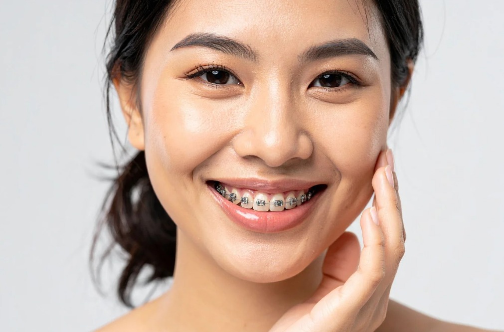 Top Orthodontic Care Options for Teens in Phoenix