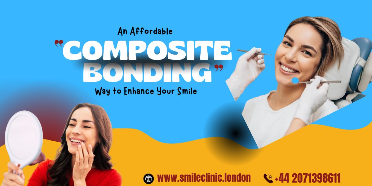 Composite Bonding: An Affordable Way to Enhance Your Smile