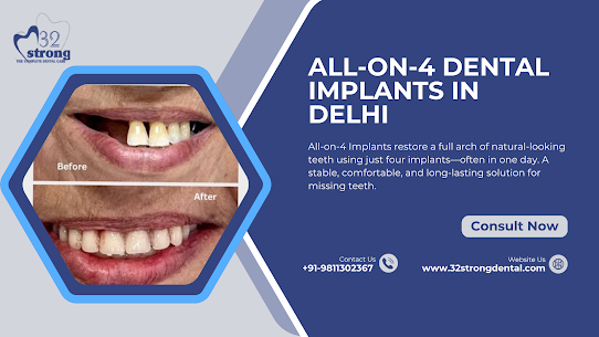 Full-Arch Rehabilitation: Mastering the All-on-4 Technique in Delhi