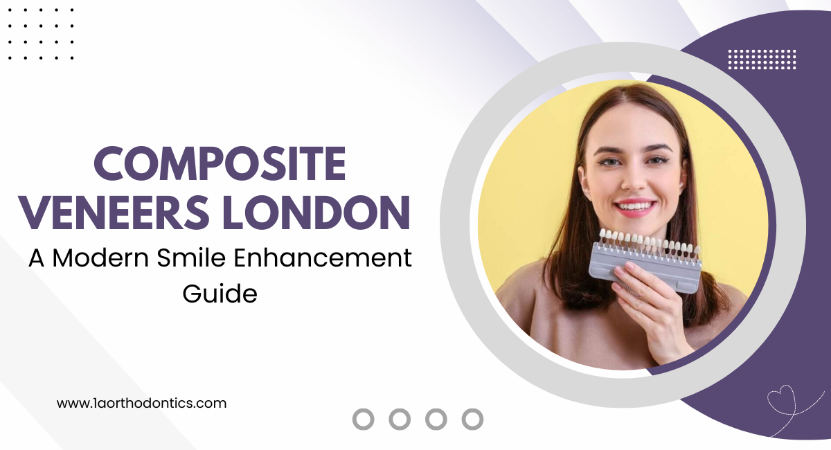 Composite Veneers London: A Modern Smile Enhancement Guide