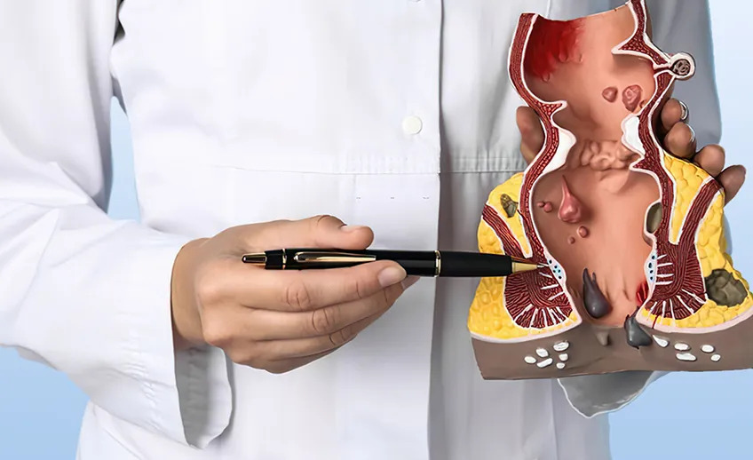 Is Piles Surgery Painful? Modern Treatments Available in Vadodara