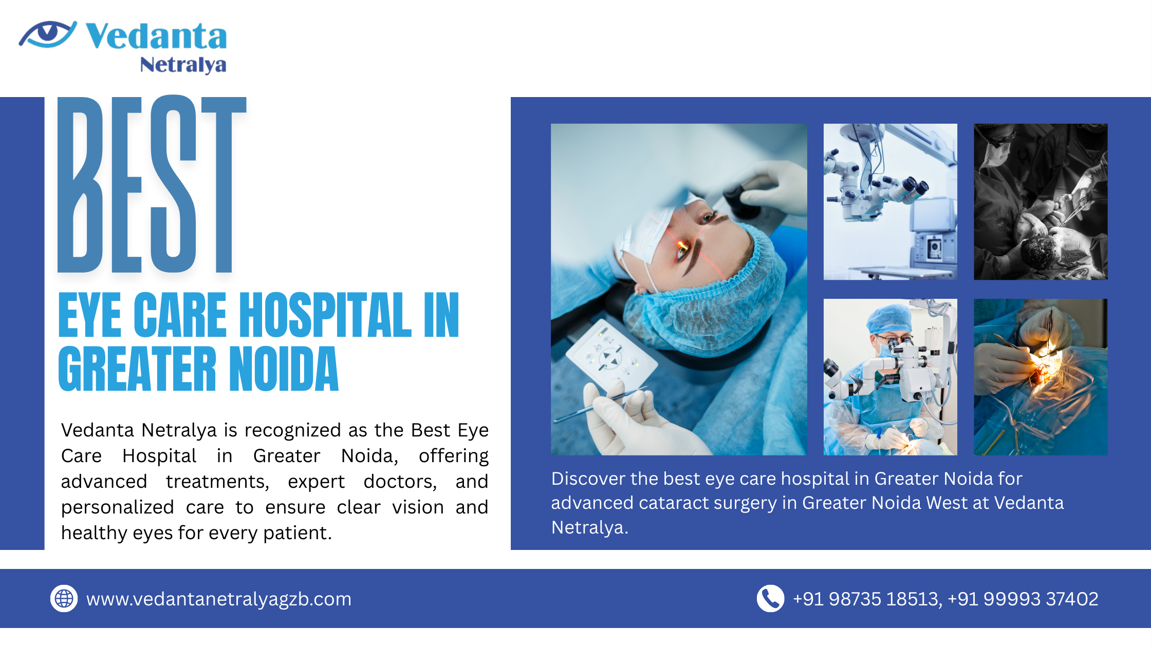 Best Eye Care Hospital in Greater Noida: A Complete Guide to Quality Vision Care