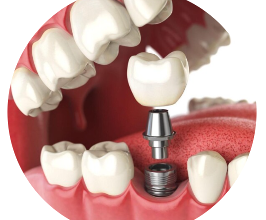 Affordable Dentist Makati for Quality and Reliable Dental Care