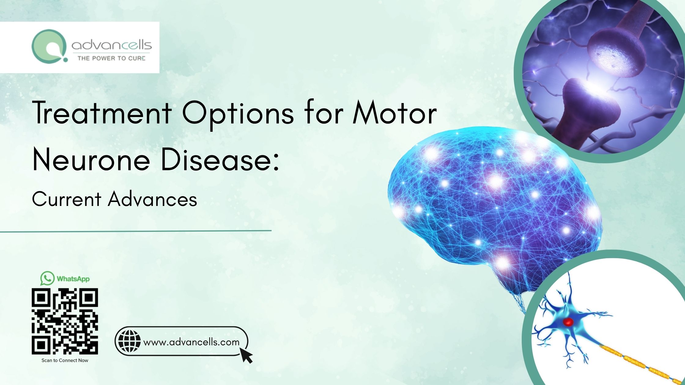 Treatment Options for Motor Neurone Disease: Current Advances