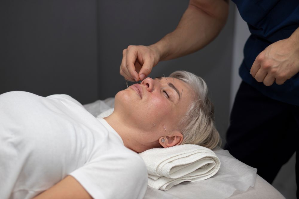 How Acupuncture for Keratoconus Treatment Can Support Vision Wellness