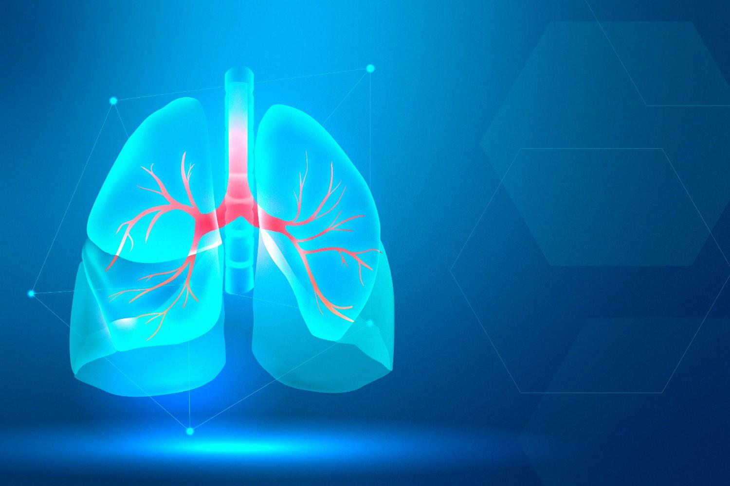 What causes fluid on the lungs? Pulmonary edema symptoms and treatment