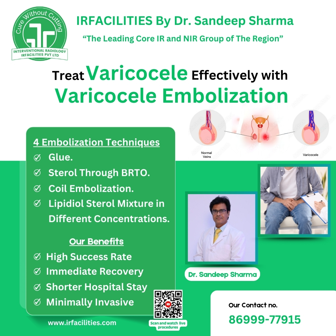 Varicocele Embolization Cost in India – Treatment, Recovery
