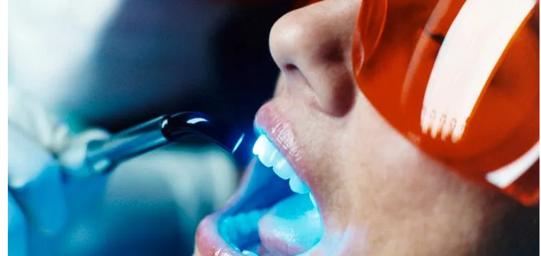 Professional Teeth Whitening Dentist Makati for a Brighter Confident Smile