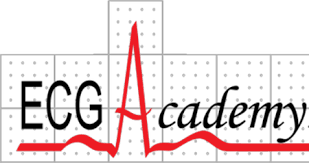 What Is the Best Advanced EKG Course to Learn to Read an EKG?