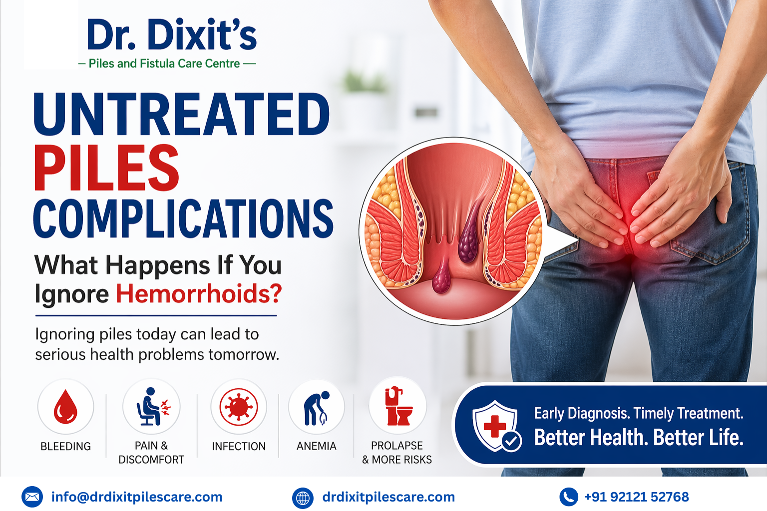 Untreated Piles Complications: What Happens If You Ignore Hemorrhoids?