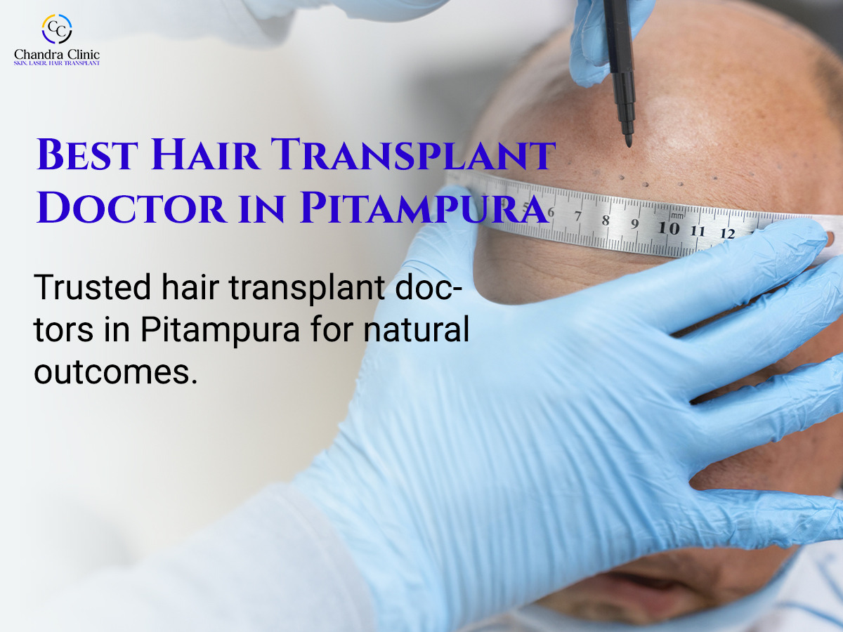 Is Hair Transplant the Right Choice for You? Here's What You Should Know