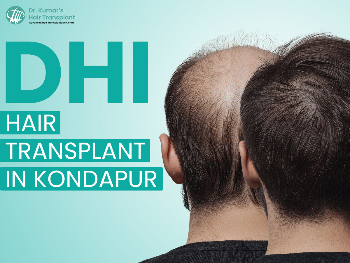 DHI vs FUE — Which Hair Transplant Method Is Right for You?