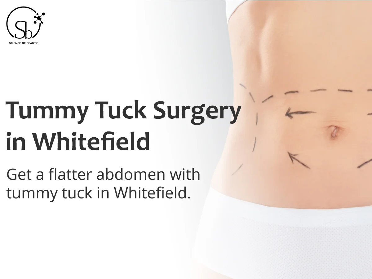 Can Men Benefit from Abdominoplasty? Here's What You Need to Know