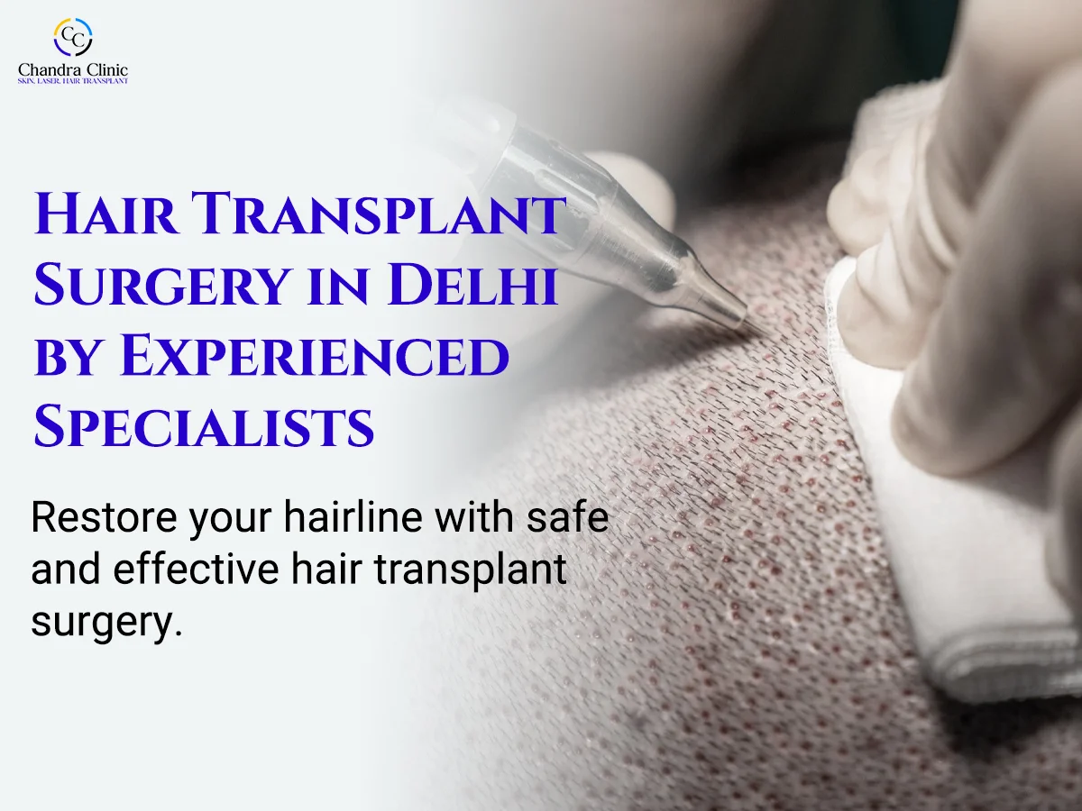Why More People in Delhi Are Choosing Hair Transplant Surgery Over Other Treatments
