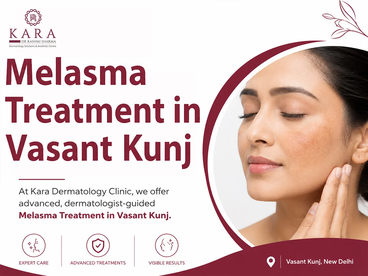 Dark Patches on Your Face That Won't Go Away? Here's What You Need to Know About Melasma