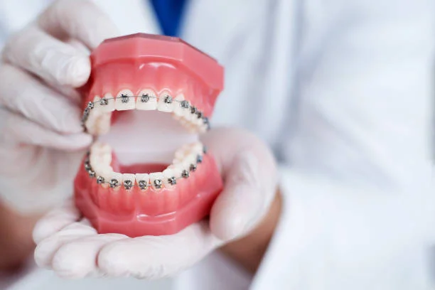 Finding the Right Orthodontist in Chatsworth: Modern Solutions for a Healthier, More Confident Smile