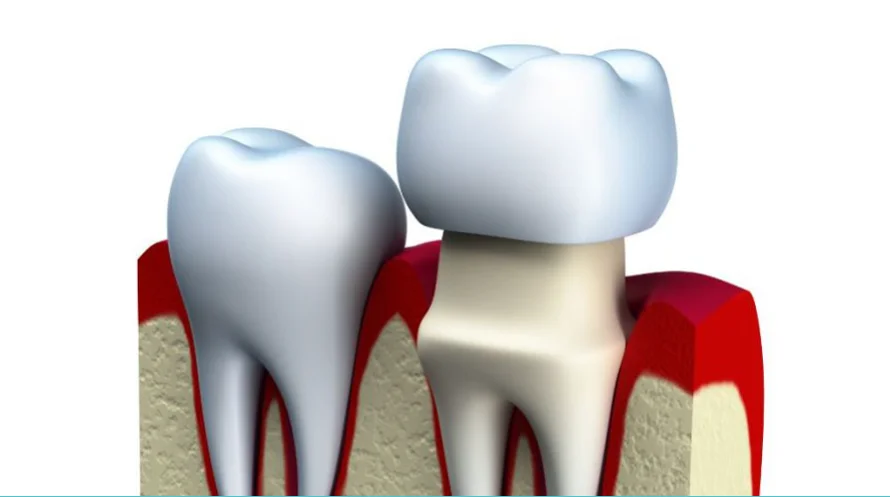 Dentist in West Pymble for Quality General and Preventive Dental Services