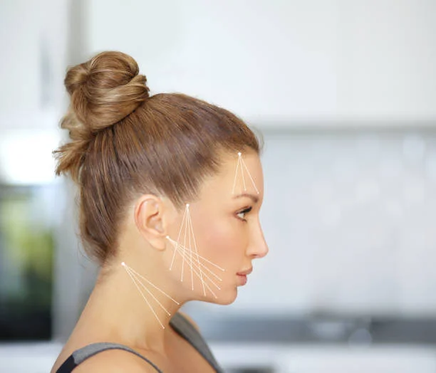 Is 8-Point Facelift in Dubai Good for Defined Facial Lines?