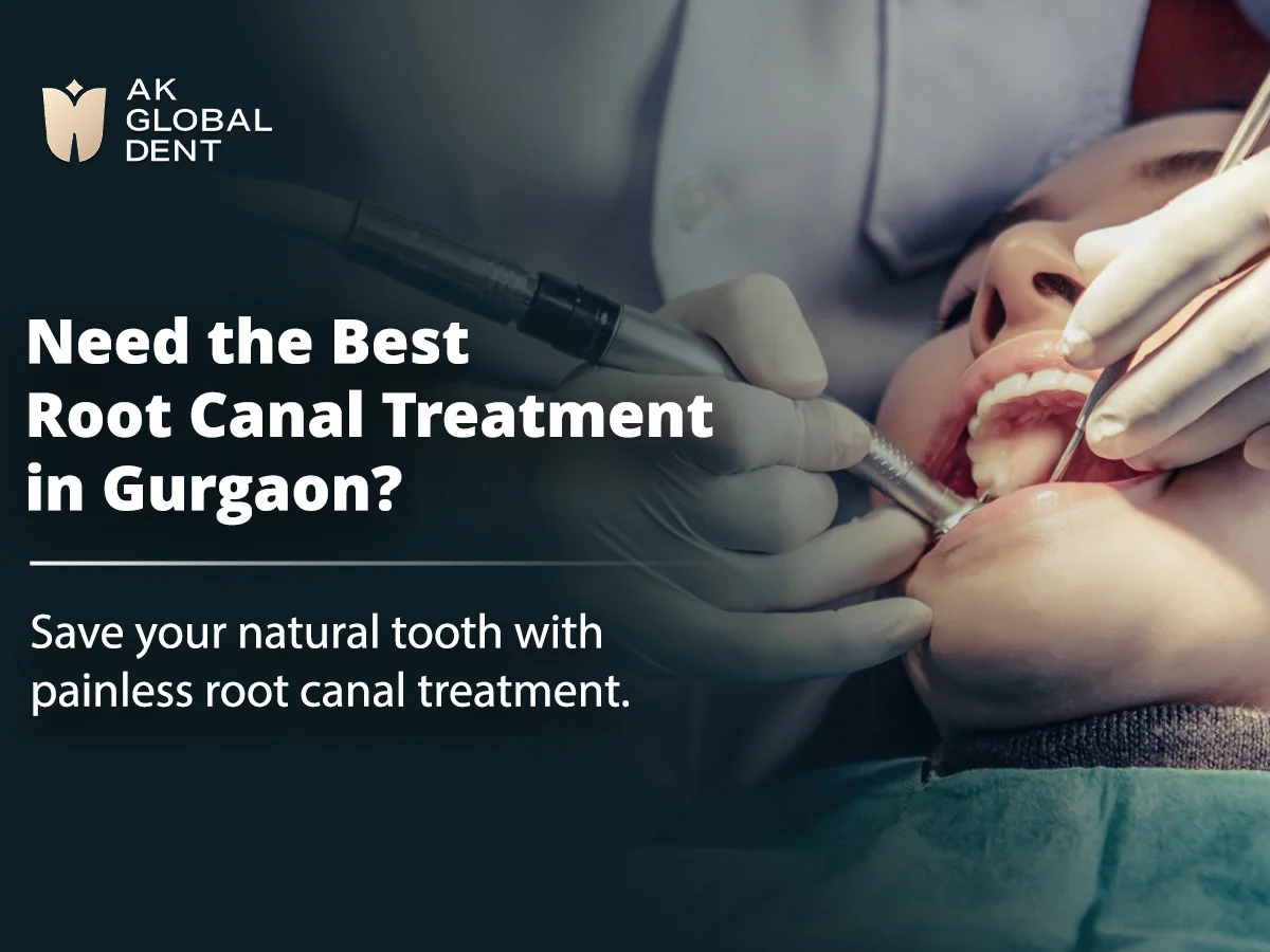 Why Toothache Should Never Be Ignored: A Simple Guide for Patients in Gurgaon