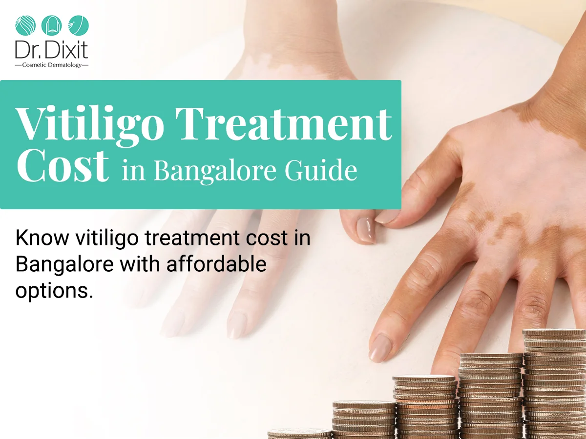 Why Vitiligo Treatment Is a Long-Term Process, Not a Quick Fix