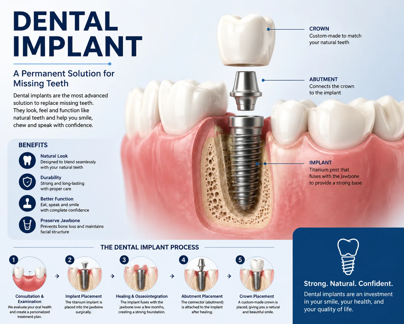 dental implants in gurgaon