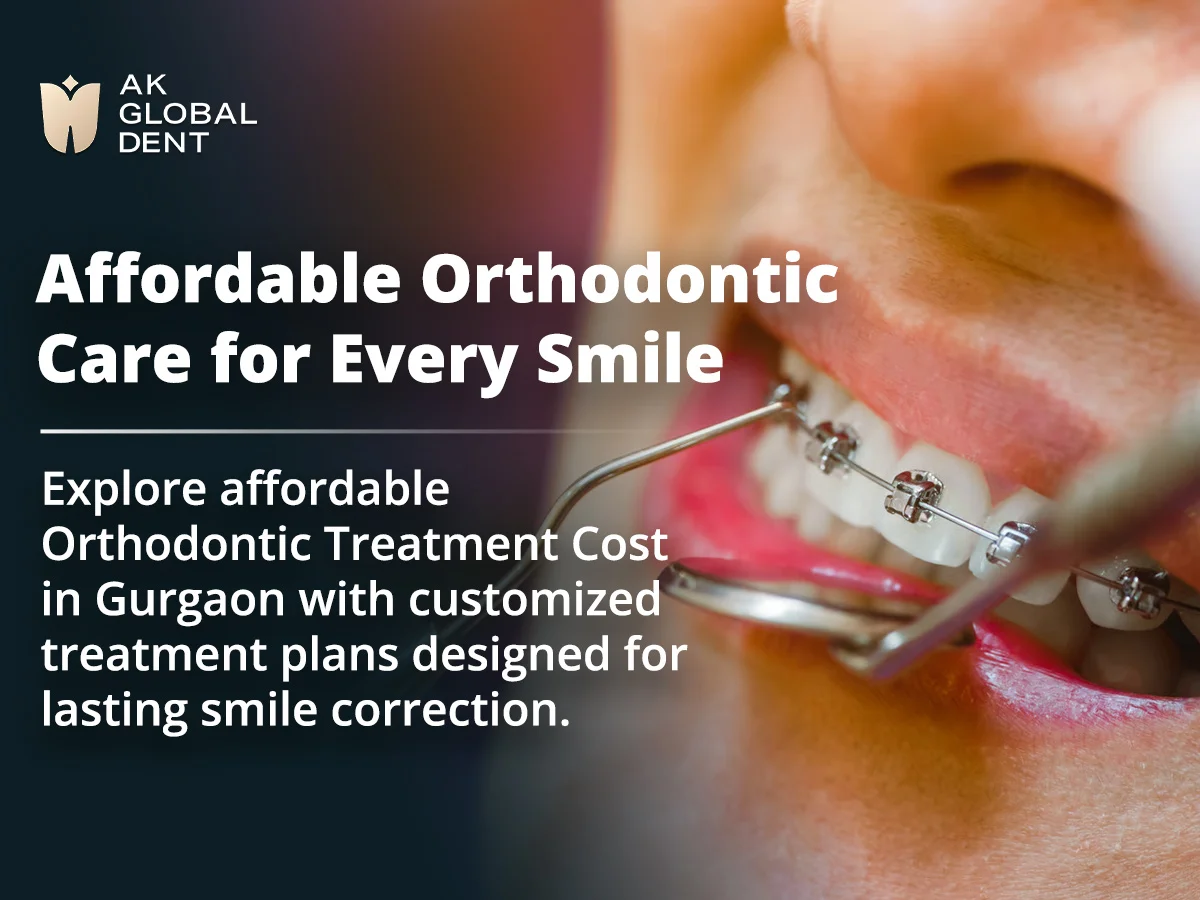 Orthodontic Treatment Cost in Gurgaon – A Complete Guide Before You Get Braces