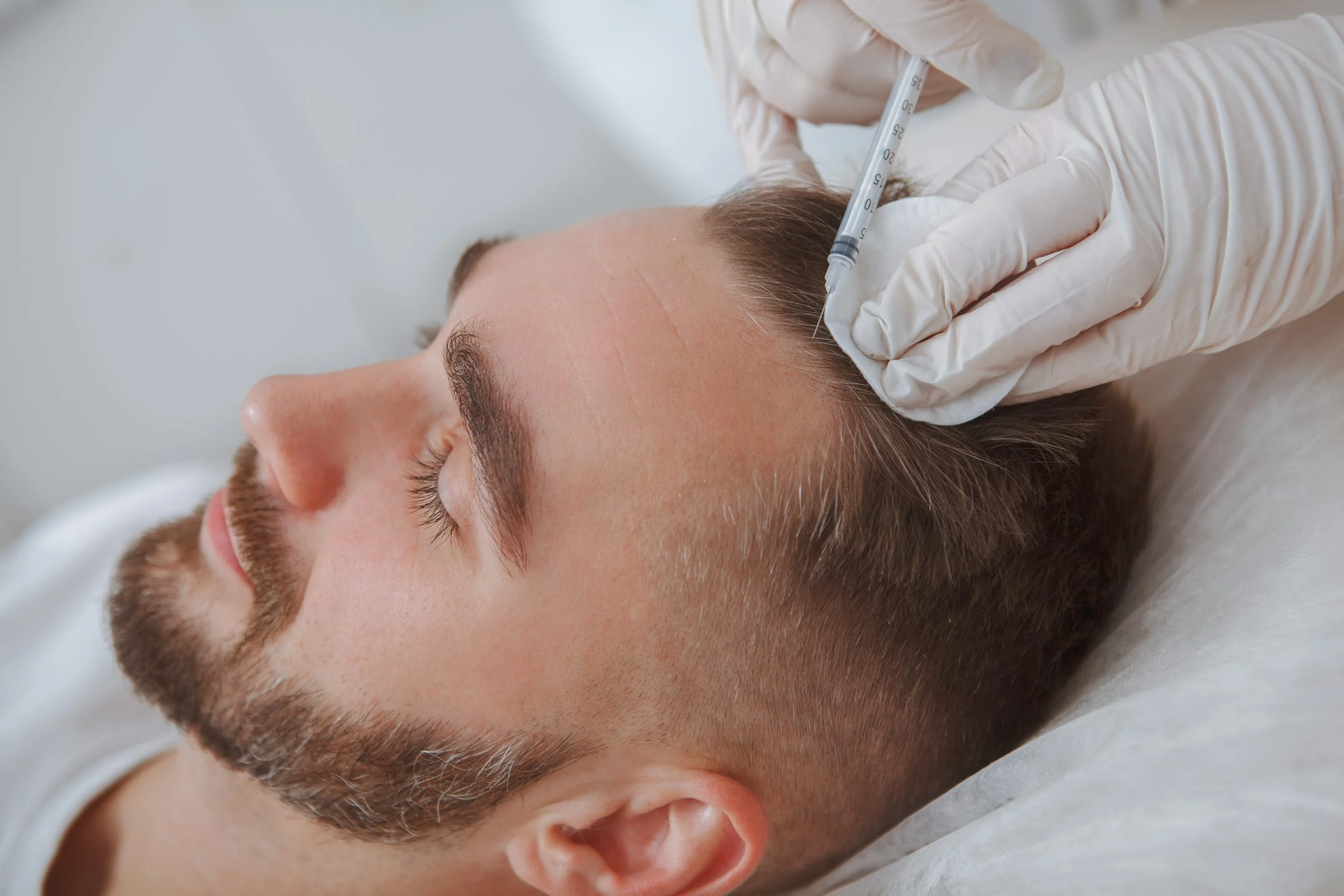 Hair Fall Problem? Know Your Treatment Options in Gurgaon