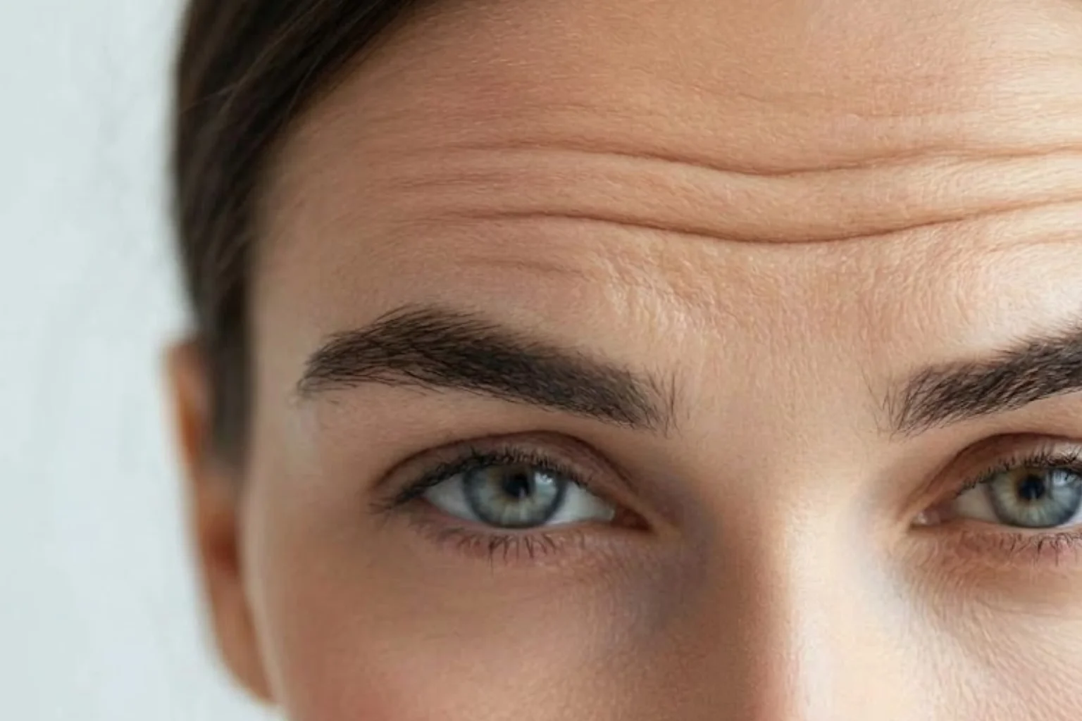 What Causes Forehead Heaviness After Anti-Wrinkle Treatment?