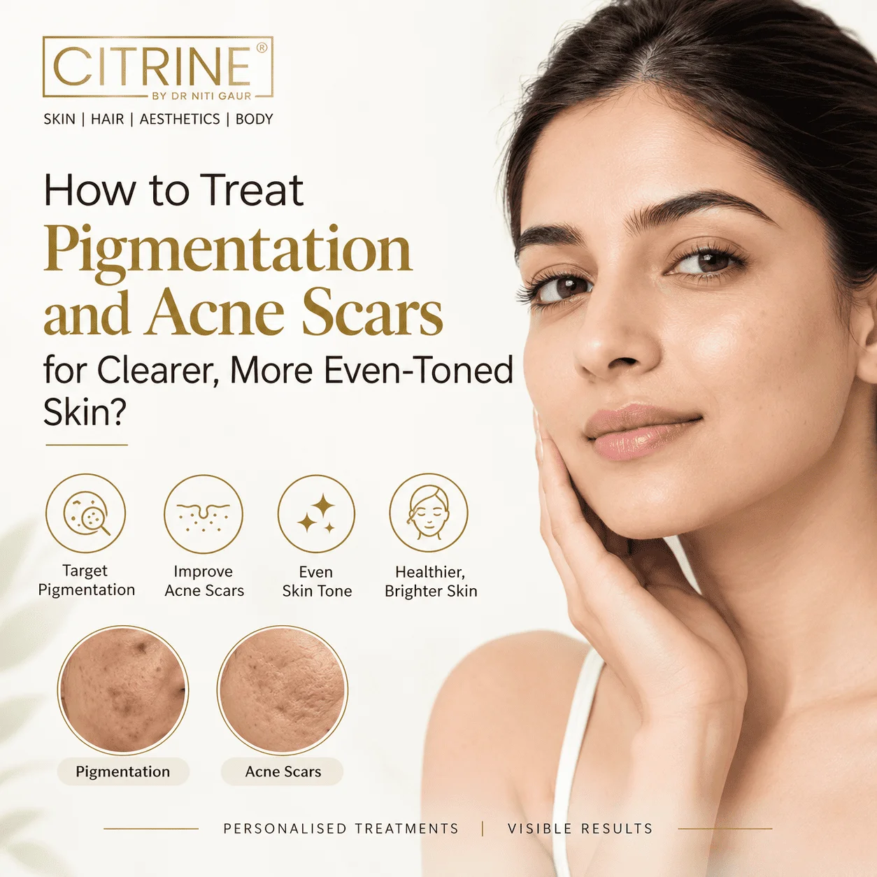 How to Treat Pigmentation and Acne Scars for Clearer, More Even-Toned Skin?