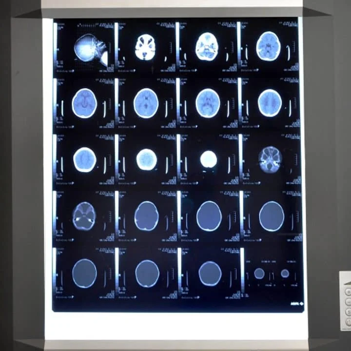 LED X-Ray View Box Supplier in India: Quality, Features, and Benefits