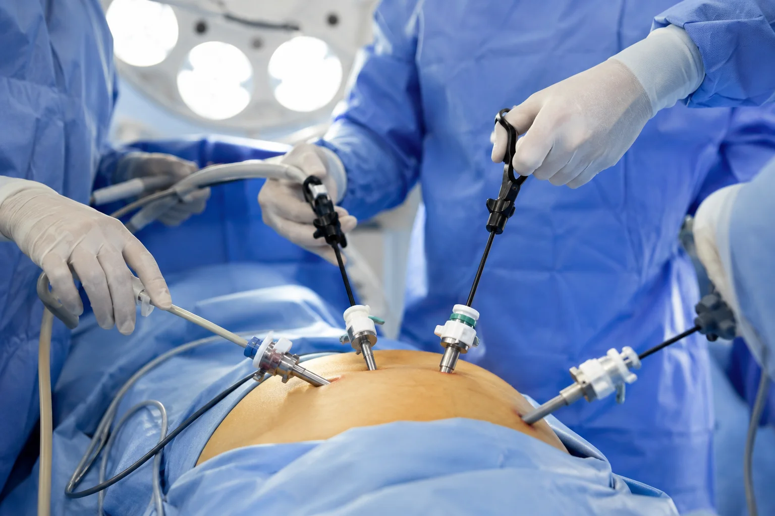 How Can Laparoscopic Hernia Surgery Help You Recover With Confidence in Abu Dhabi?