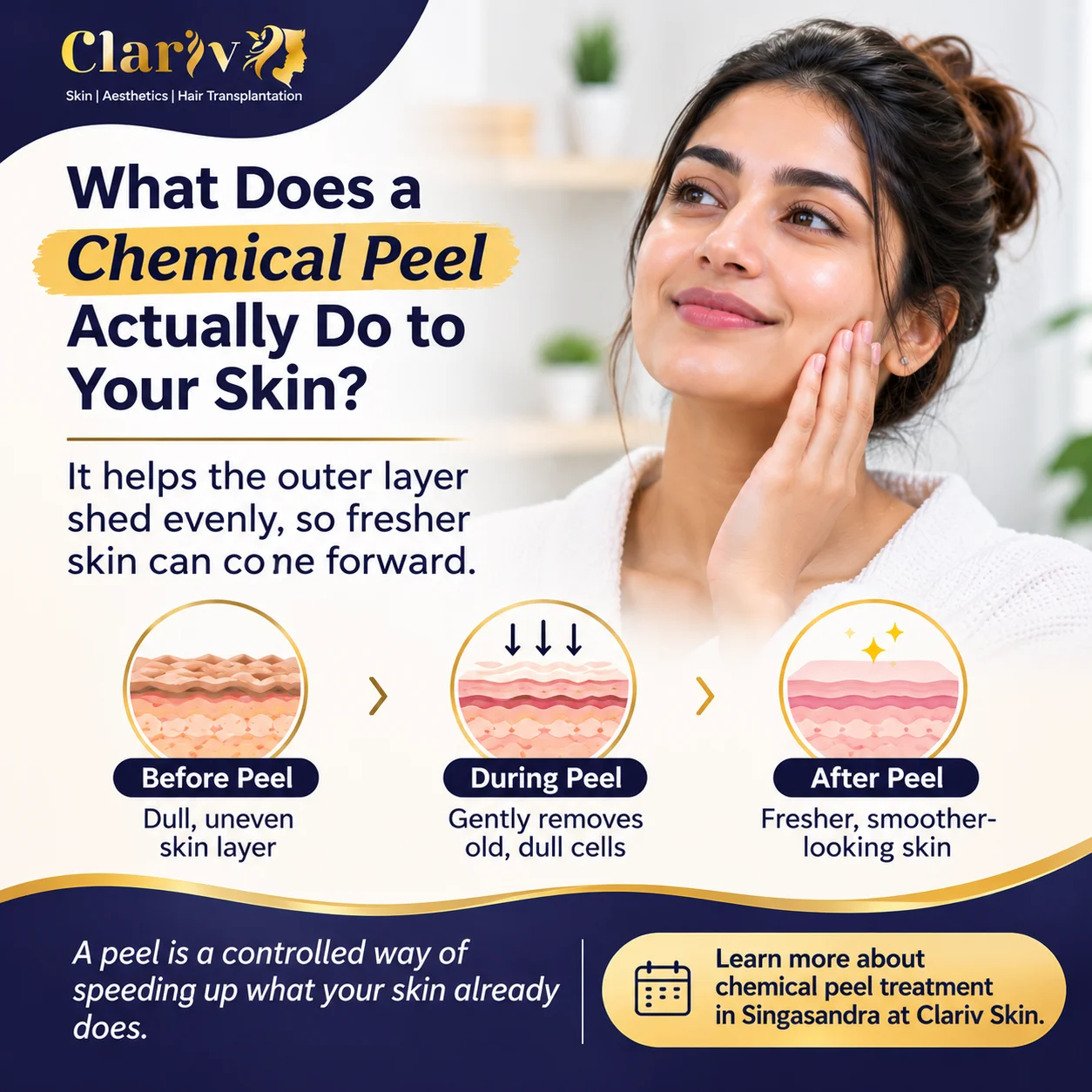 What Does Chemical Peel Treatment in Singasandra Actually Do to Your Skin? | Clariv Skin