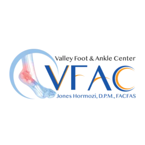 valleyfootanckel